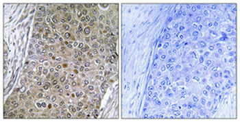 C/EBP ζ Polyclonal Antibody