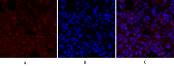 BRCA1 Polyclonal Antibody