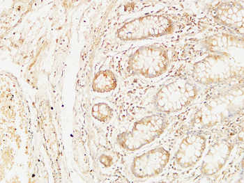Bcl-10 Polyclonal Antibody