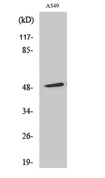 Arrestin-β-1 Polyclonal Antibody
