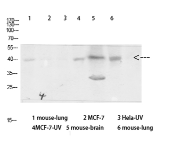 Arrestin-β-1 Polyclonal Antibody