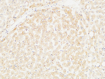 Arginase I Polyclonal Antibody