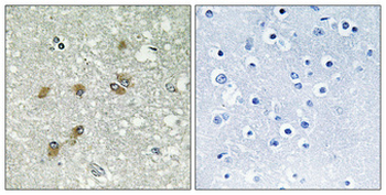 ApoL1 Polyclonal Antibody