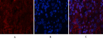 Akt Polyclonal Antibody