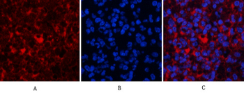 Akt Polyclonal Antibody