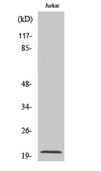 AK6 Polyclonal Antibody