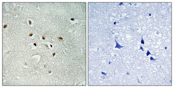 AK6 Polyclonal Antibody