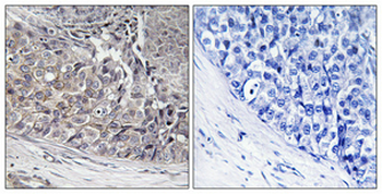 ADCK4 Polyclonal Antibody
