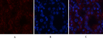 Actin β Polyclonal Antibody