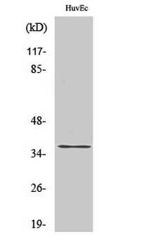 ACOT8 Polyclonal Antibody
