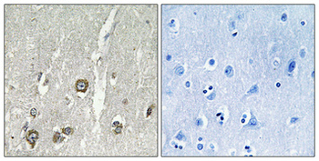 ACOT8 Polyclonal Antibody