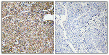 ACBP Polyclonal Antibody