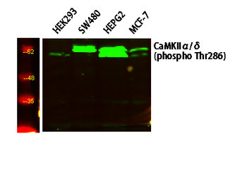 CaMK2 (Phospho-Thr286) Antibody