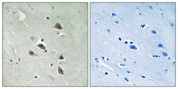 p70 S6 kinase α (phospho Ser427) Polyclonal Antibody