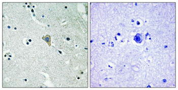 ErbB-3 (phospho Tyr1328) Polyclonal Antibody