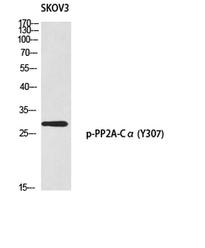 PP2A-Cα (phospho Tyr307) Polyclonal Antibody