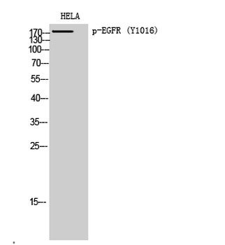 EGFR (phospho Tyr1016) Polyclonal Antibody