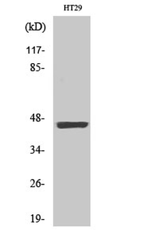 Cytokeratin 18 (phospho Ser33) Polyclonal Antibody