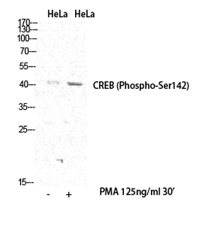 CREB-1 (phospho Ser142) Polyclonal Antibody