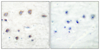 Adducin α/β (phospho Ser726/713) Polyclonal Antibody