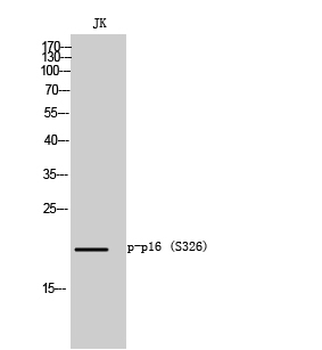 p16 (phospho Ser326) Polyclonal Antibody