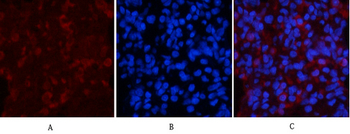 CaMKIIβ/γ/δ (phospho Thr287) Polyclonal Antibody