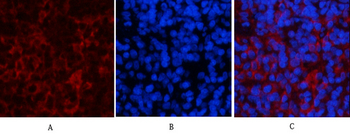 CaMKIIβ/γ/δ (phospho Thr287) Polyclonal Antibody