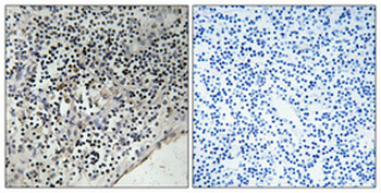 Cdc37 (phospho Ser13) Polyclonal Antibody