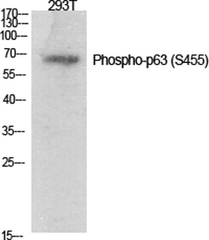 p63 (phospho Ser455) Polyclonal Antibody