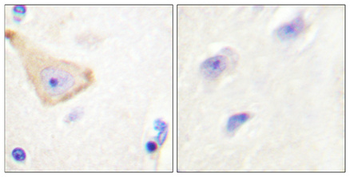 IL-3Rβ (phospho Tyr593) Polyclonal Antibody