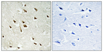 GRF-1 (phospho Tyr1105) Polyclonal Antibody