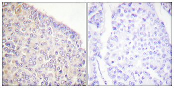 Syk (phospho Tyr525) Polyclonal Antibody
