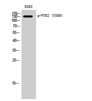 PYK2 (phospho Tyr580) Polyclonal Antibody