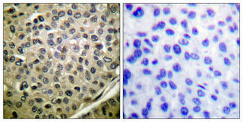 Stat4 (phospho Tyr693) Polyclonal Antibody