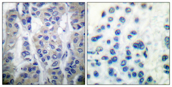 LIMK-1/2 (phospho Thr508/505) Polyclonal Antibody