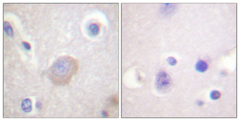 SH-PTP2 (phospho Tyr542) Polyclonal Antibody