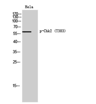 Chk2 (phospho Thr383) Polyclonal Antibody