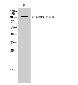 EphA2/5 (phospho Tyr594) Polyclonal Antibody