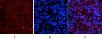 ERK 1/2 (phospho Tyr222/205) Polyclonal Antibody