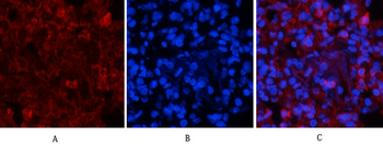 ERK 1/2 (phospho Tyr222/205) Polyclonal Antibody