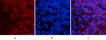 ERK 1/2 (phospho Tyr222/205) Polyclonal Antibody
