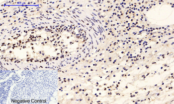 ERK 1/2 (phospho Tyr222/205) Polyclonal Antibody