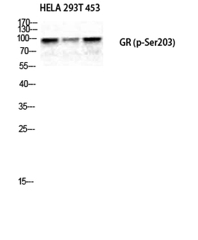 GR (phospho Ser203) Polyclonal Antibody