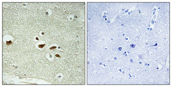 hnRNP K (phospho Ser284) Polyclonal Antibody