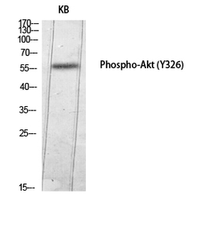 Akt (phospho Tyr326) Polyclonal Antibody