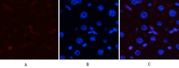 p38 (phospho Thr180/Y182) Polyclonal Antibody