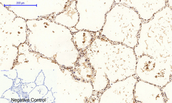 p38 (phospho Thr180/Y182) Polyclonal Antibody