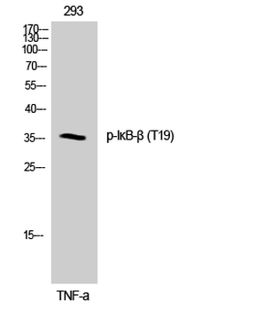 IκB-β (phospho Thr19) Polyclonal Antibody