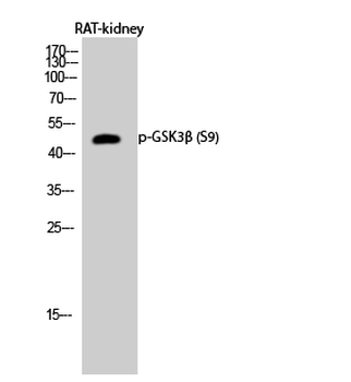 GSK3β (phospho Ser9) Polyclonal Antibody