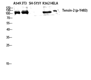 Tensin-2 (phospho Tyr483) Polyclonal Antibody
